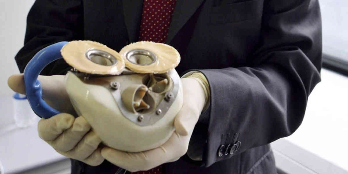 Implantation réussie pour le cœur artificiel de la société française Carmat