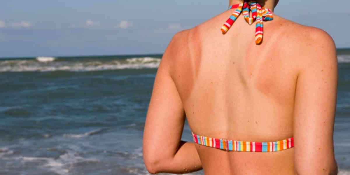 Ces nouvelles tendances de bronzage, dangereuses pour la santé
