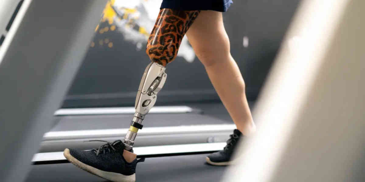 Les industriels alertent sur un risque de pénuries d'implants pour les prothèses orthopédiques