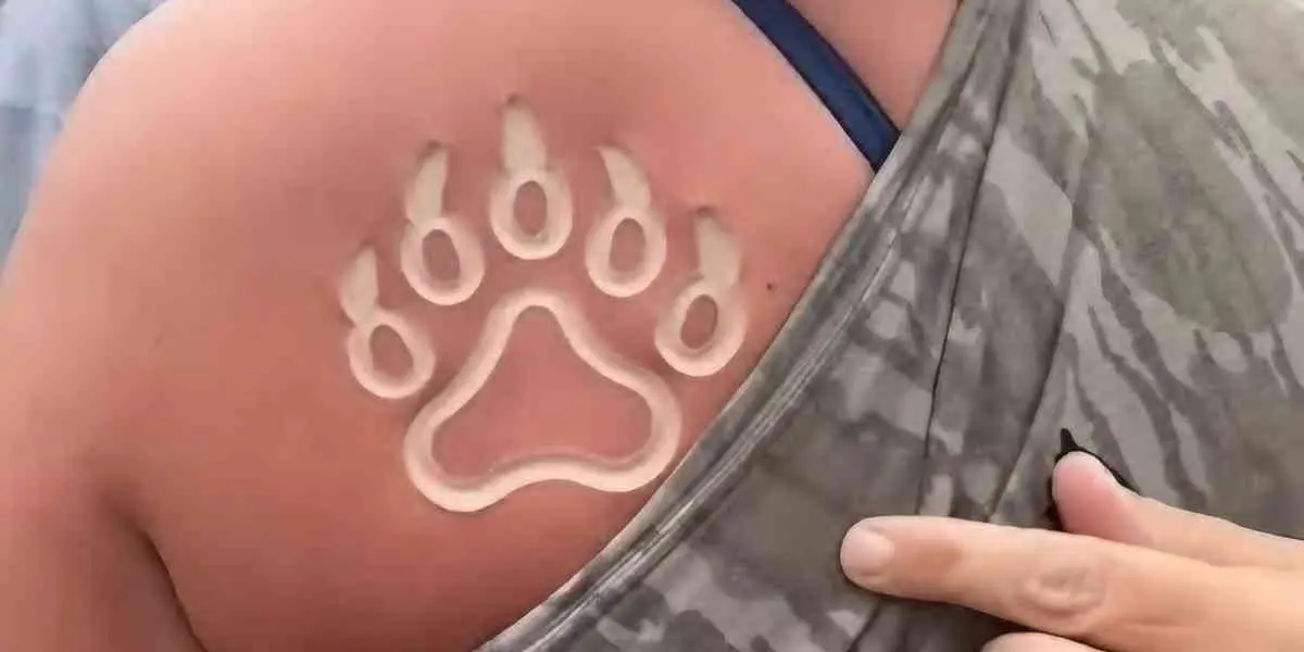 Freeze branding : le tatouage par le froid, peut provoquer nécroses et cancers