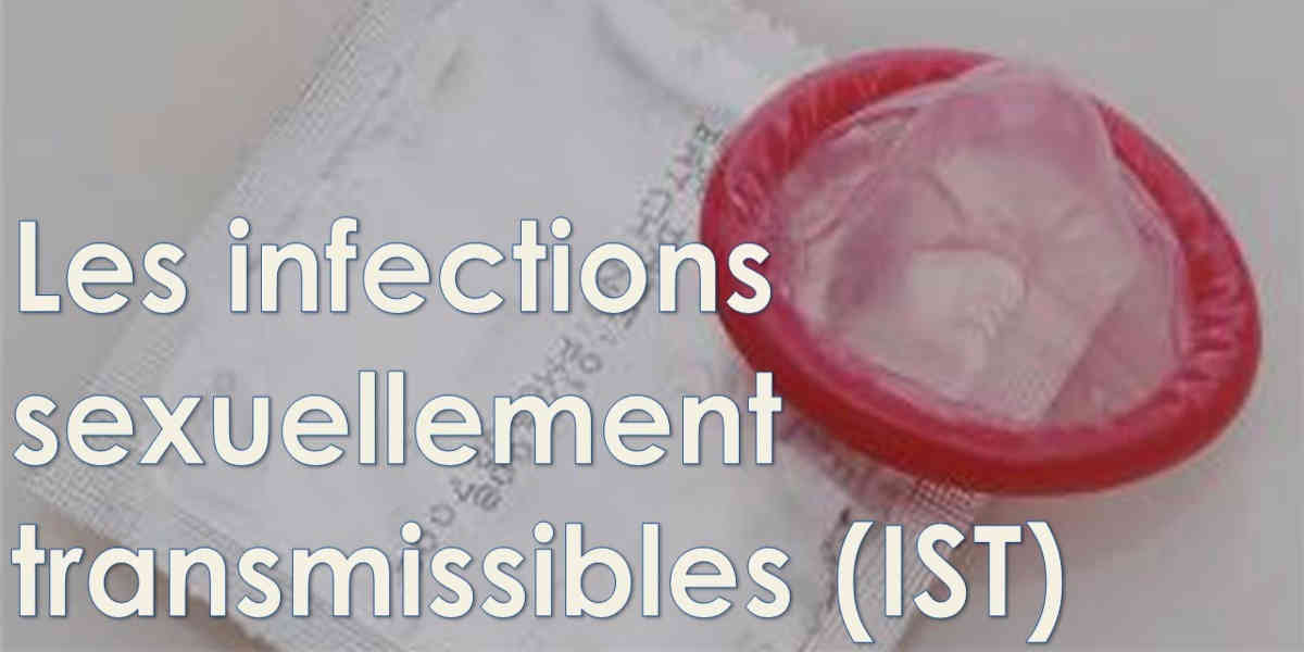 En Europe, les infections sexuellement transmissibles atteignent des niveaux records