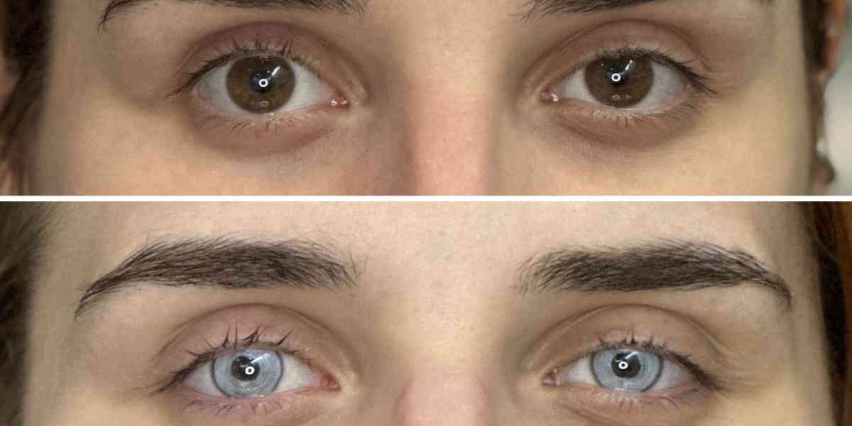 Changer la couleur de ses yeux : la tendance qui terrifie les médecins
