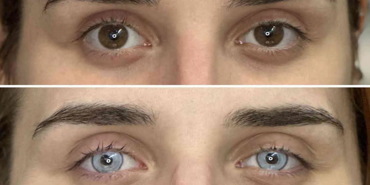 Changer la couleur de ses yeux : la tendance qui terrifie les médecins